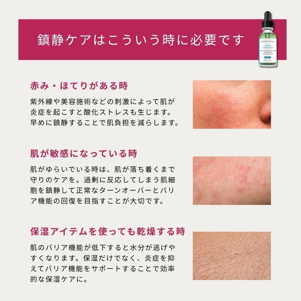 鎮静ケアは赤み、ほてり、敏感肌、インナードライ、乾燥に有効